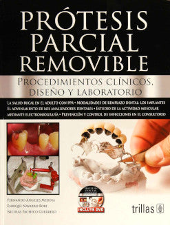 PRÓTESIS PARCIAL REMOVIBLE. INCLUYE DVD